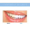 LED Teeth Whitening - Bestgoodshop