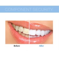 LED Teeth Whitening - Bestgoodshop